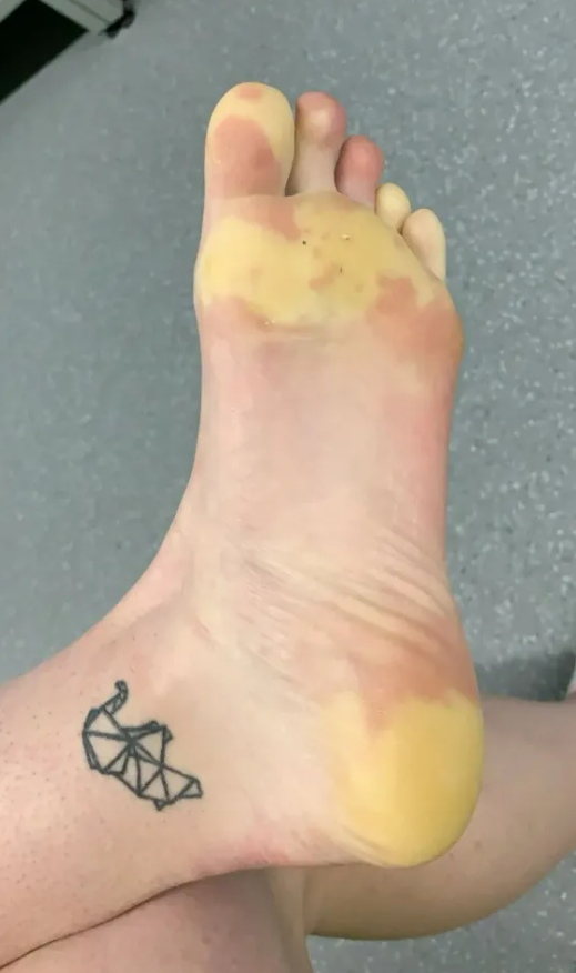 健身用的手套_手套健身用有什么好处_健身手套有什么用